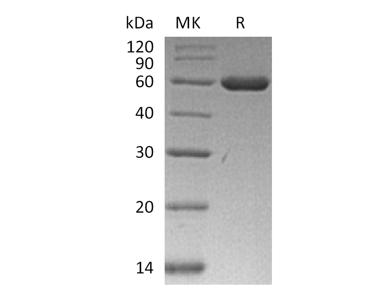 Recombinant Human ARRB1 (C-6His)