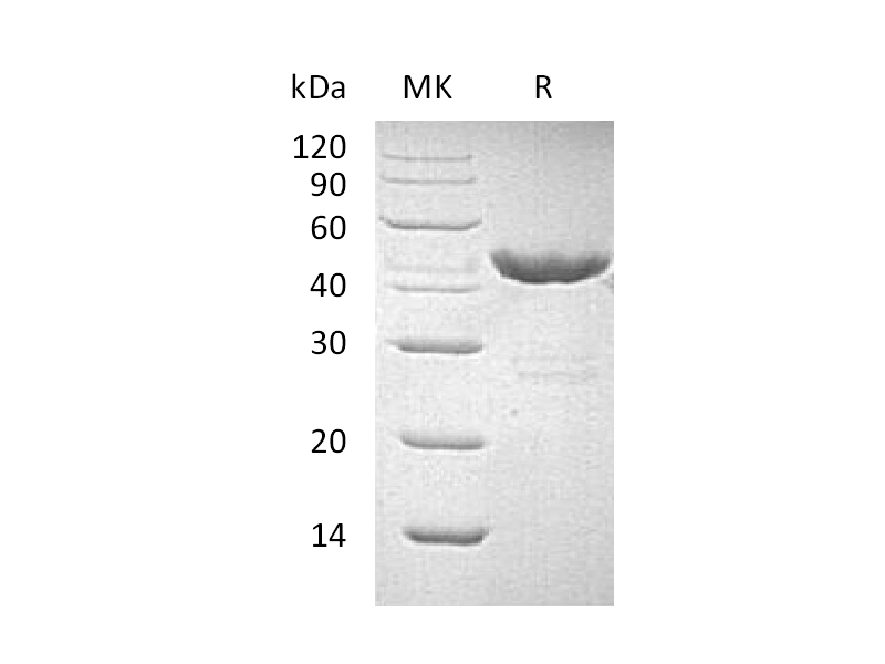 Recombinant Human GOT1 (C-6His)