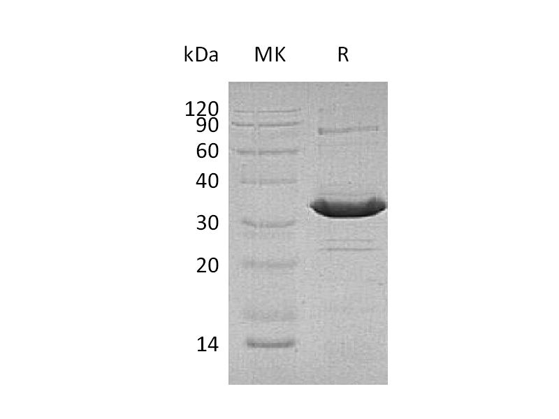 Recombinant Human ATF1 (C-6His)