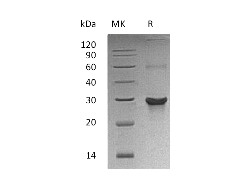 Recombinant Human ATG10 (C-6His, N-T7 tag)