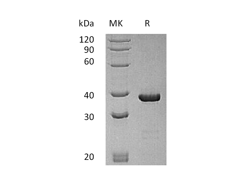 Recombinant Human ATG3