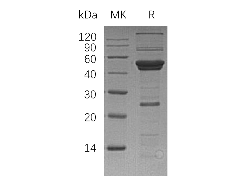 Recombinant Human ATG4A (N-6His)