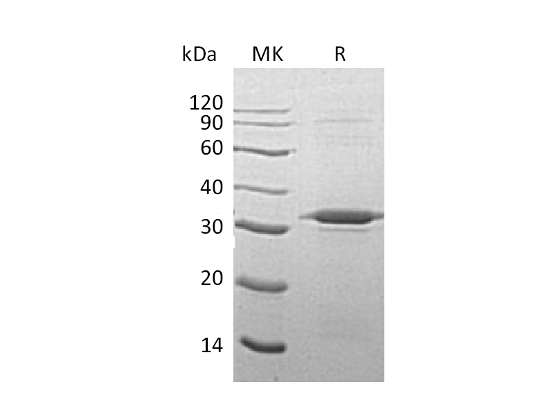 Recombinant Human ATG5
