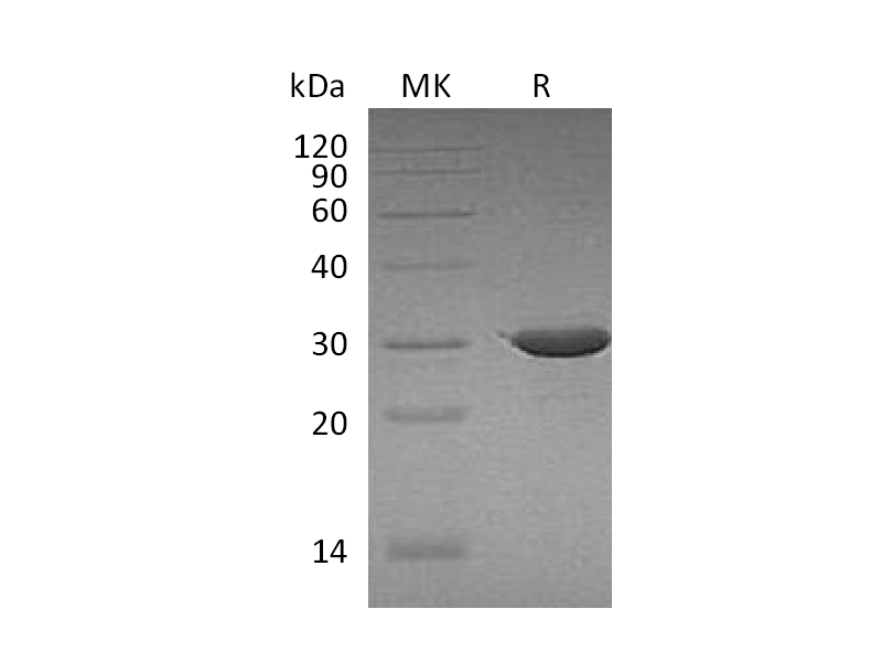 Recombinant Human ABCB5 (N-Trx)