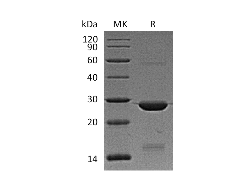 Recombinant Human BAG2 (N-6His)