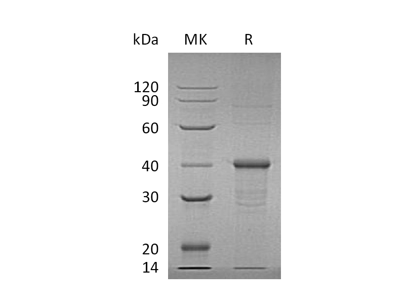 Recombinant Human BDH1 (N-6His)
