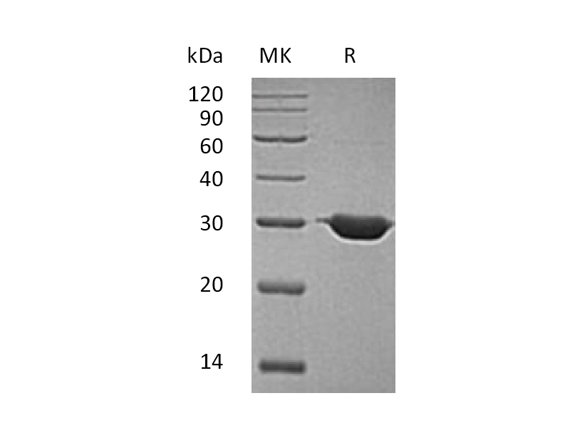 Recombinant Human BDH2 (N-6His)