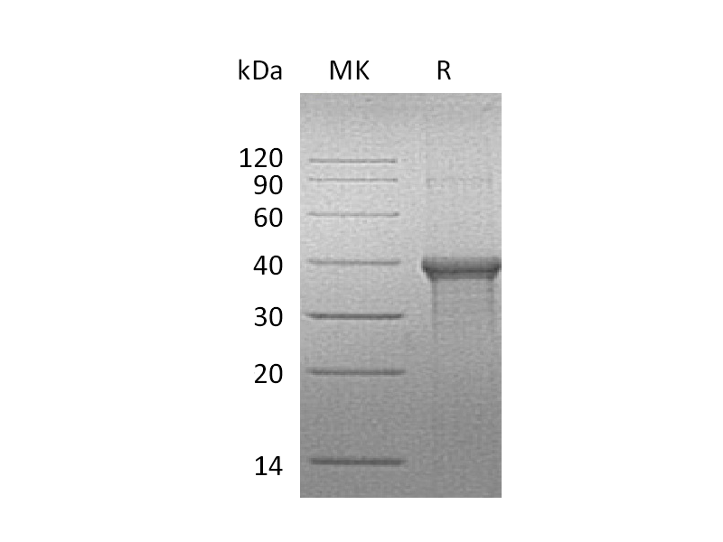 Recombinant Human BLVRA (C-6His)