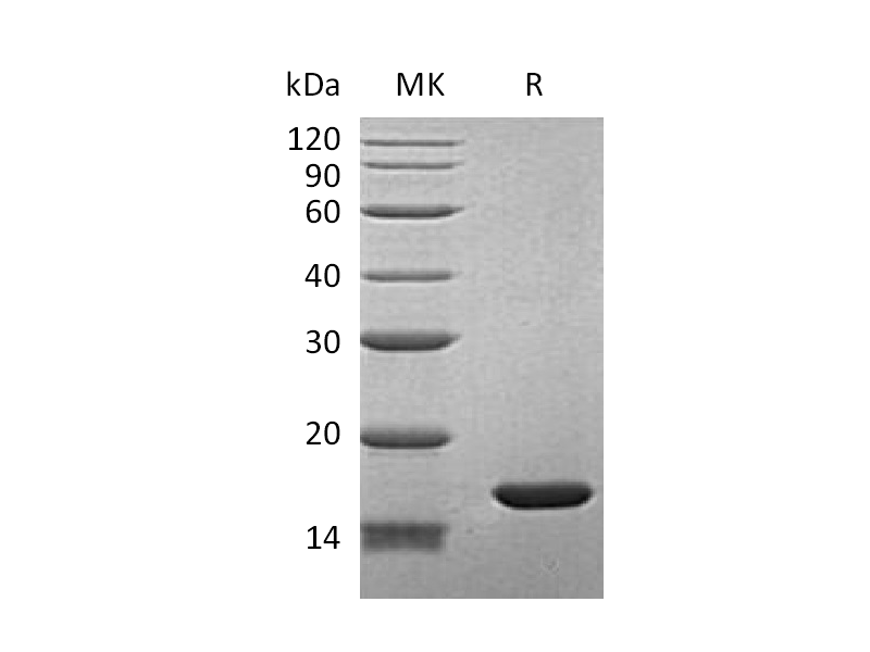 Recombinant Human FABP7 (N-6His)