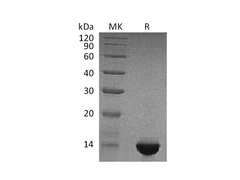 Recombinant Human NT-proBNP (N-6His-Flag)