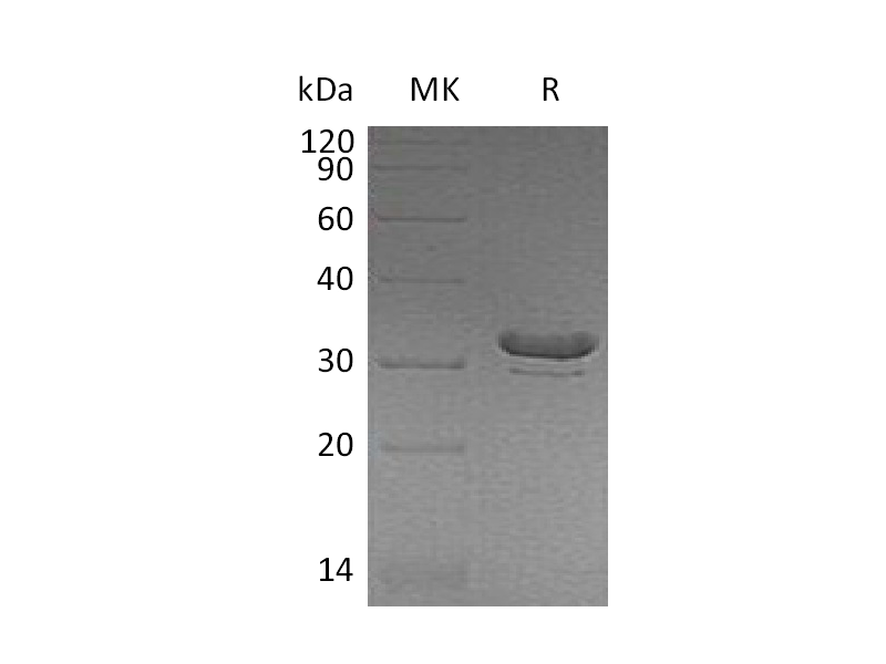 Recombinant Human BIN2 (N-6His)