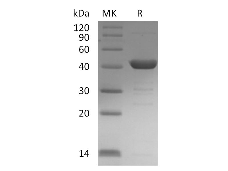 Recombinant Human UPB1 (C-6His)