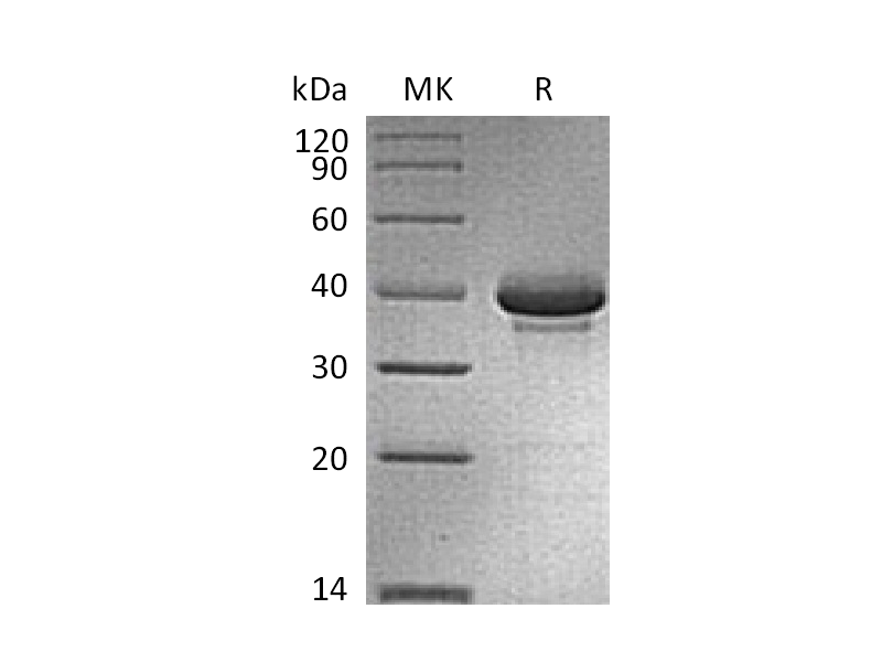 Recombinant Human CALCB (C-Fc)