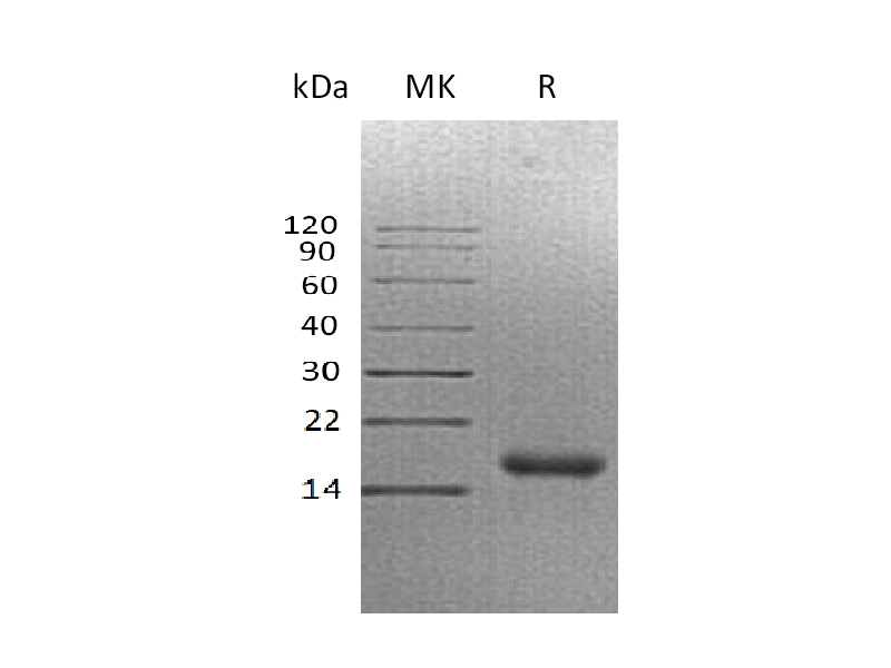 Recombinant Human CALCA (C-6His)