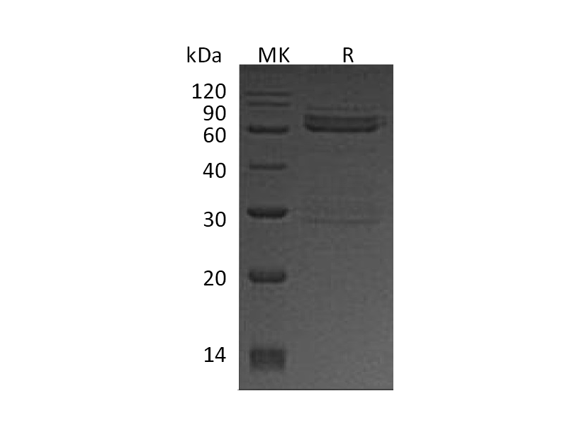 Recombinant Human CAMK1D (N-GST)