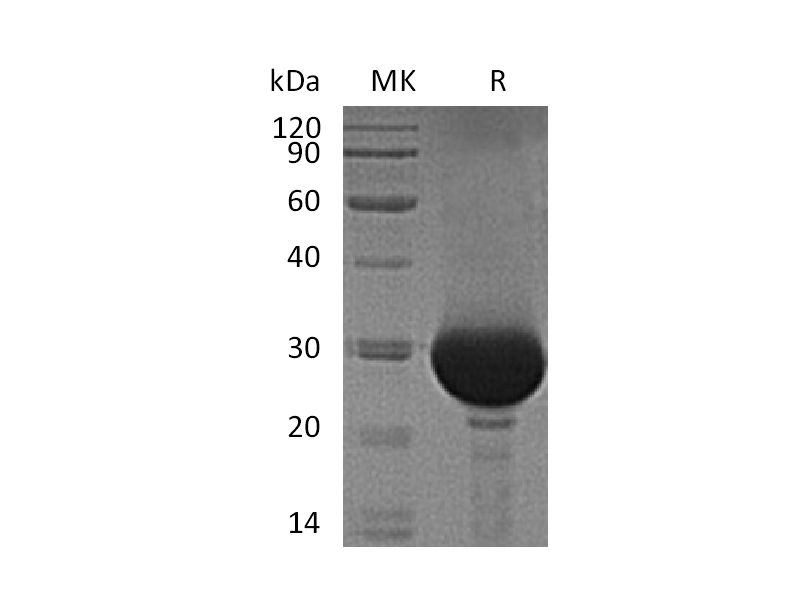 Recombinant Human Carbonic Anhydrase 1 (C-6His)