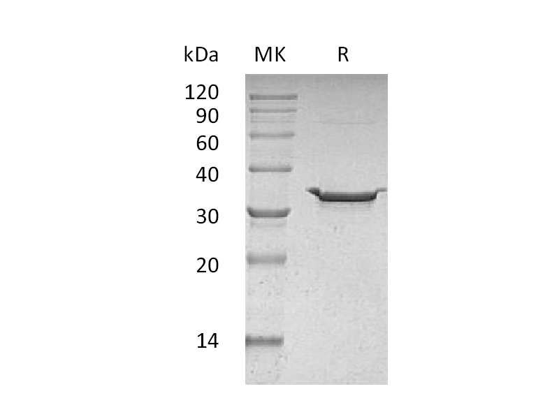 Recombinant Human Carbonic Anhydrase 5B (C-6His)