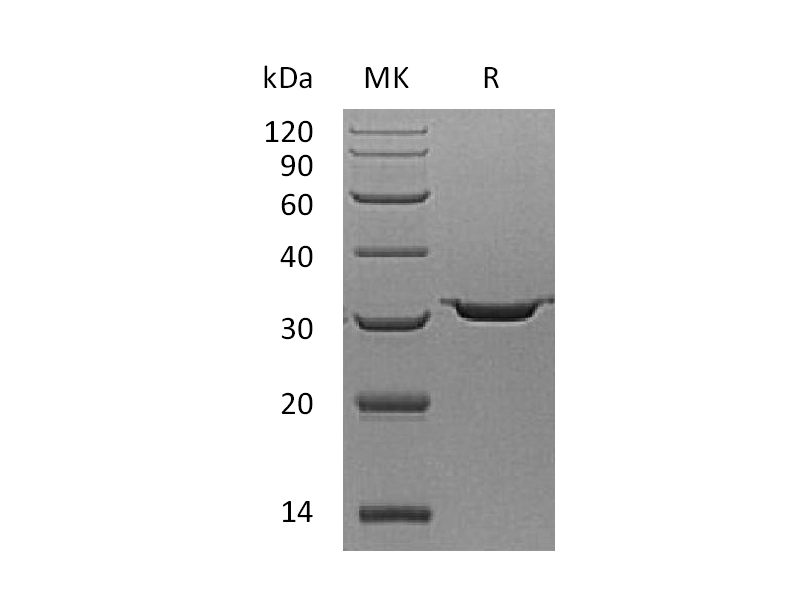 Recombinant Human Carbonic Anhydrase 7 (C-6His)