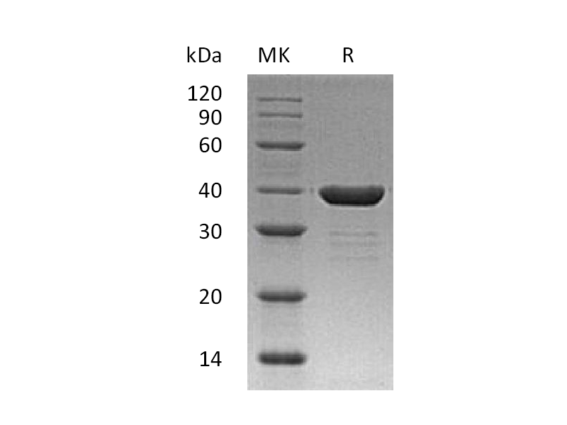 Recombinant Human Carbonic Anhydrase 8 (C-6His)