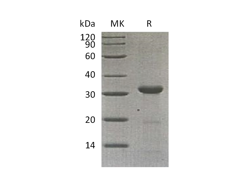 Recombinant Human Carbonic Anhydrase 10 (C-6His)