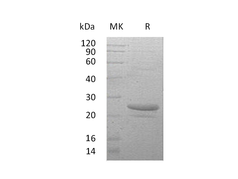 Recombinant Human CT-1 (N-6His)