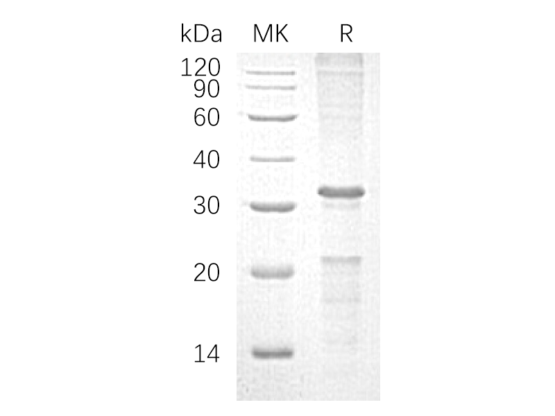 Recombinant Human CASP10 (C-6His)