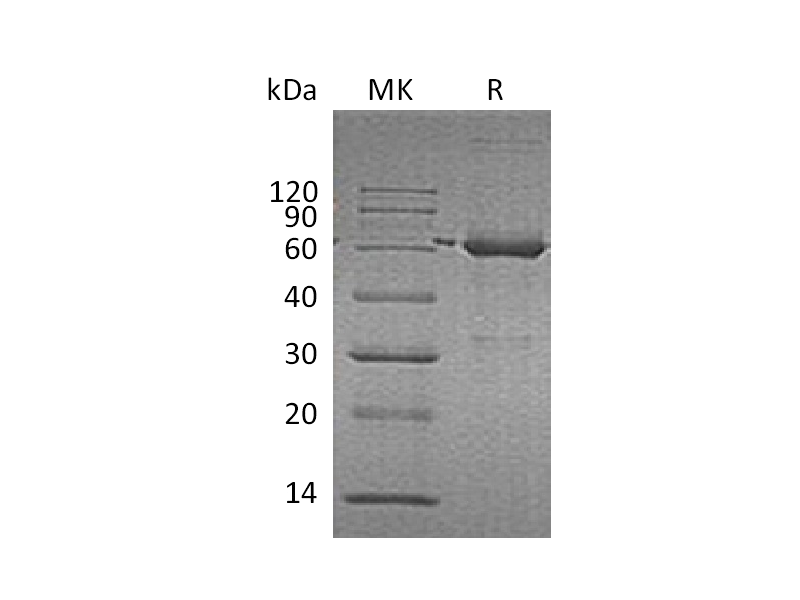 Recombinant Human CAT