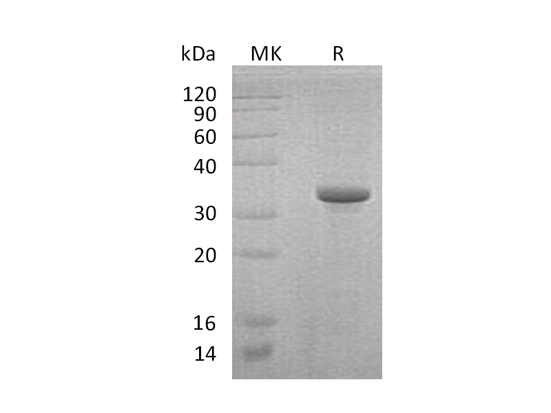 Recombinant Human Endoglin (N-Trx-6His)