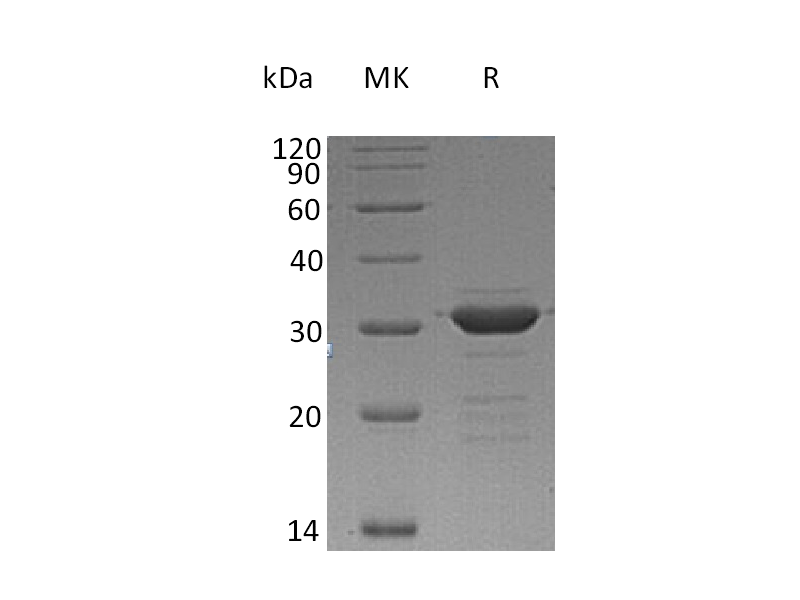 Recombinant Human CD72 (N-Trx-6His)
