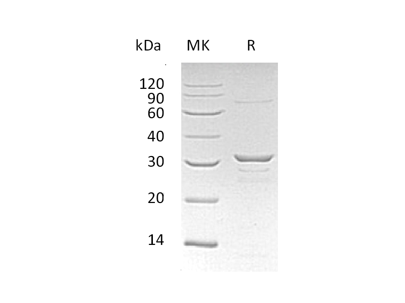 Recombinant Human CLIC1 (N-6His)