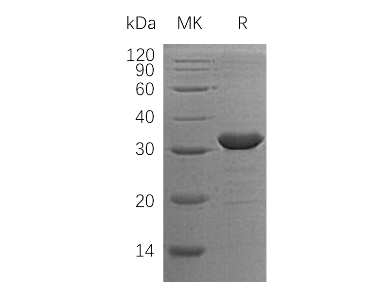 Recombinant Human CLIC2 (N-6His)