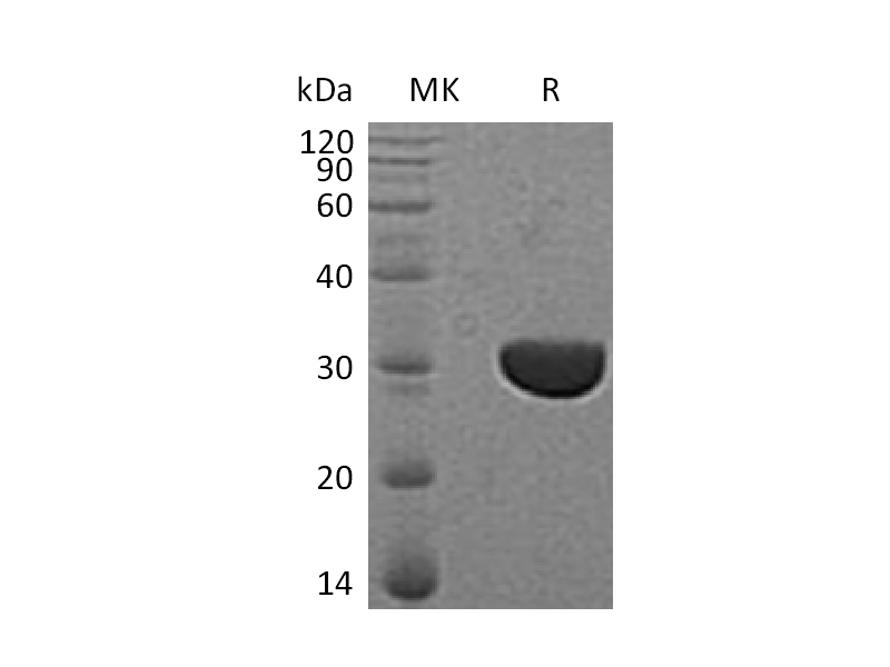 Recombinant Human CLIC3 (C-6His)