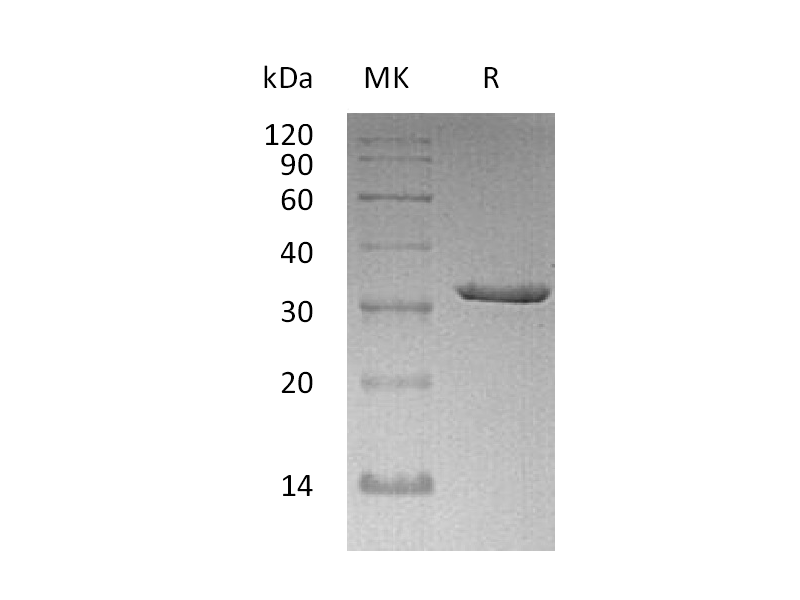 Recombinant Human CLIC5 (N-6His)