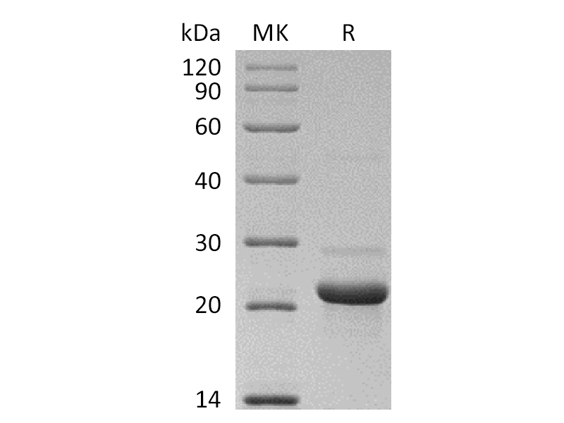 Recombinant Human C8 gamma (N-6His)