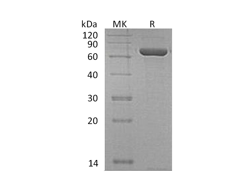 Recombinant Human CPNE1 (N, C-6His)