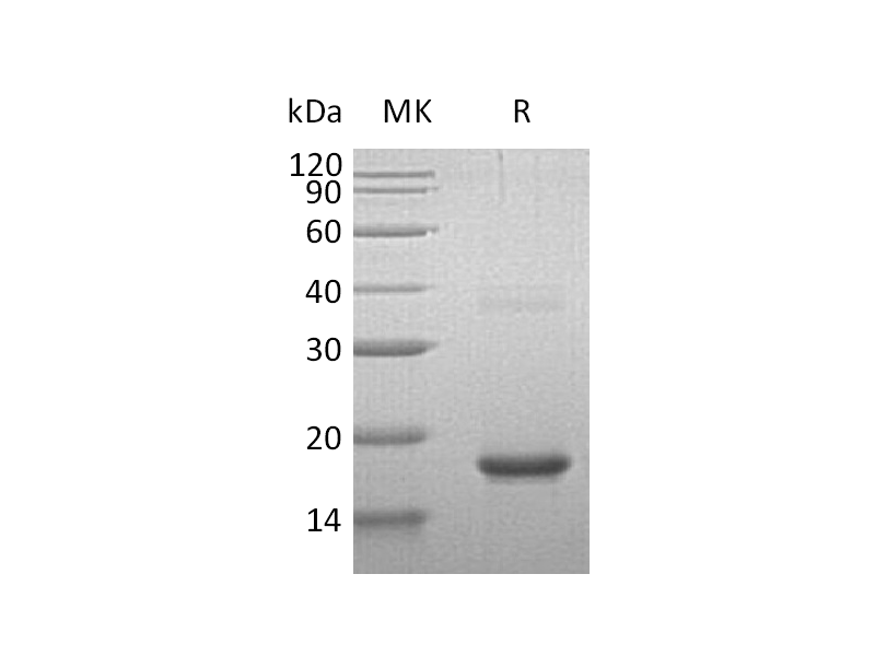 Recombinant Human Cornulin (N-6His)