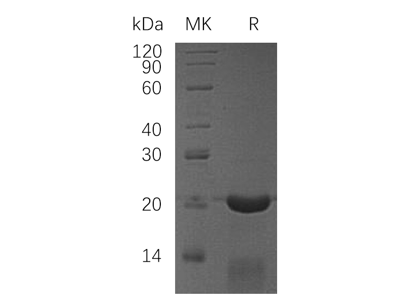 Recombinant Human CRADD