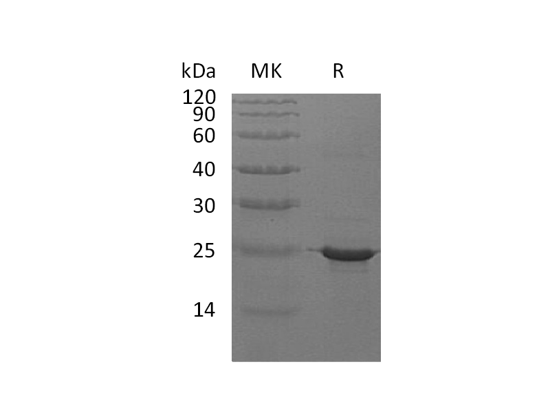 Recombinant Human CRYAB (C-6His)