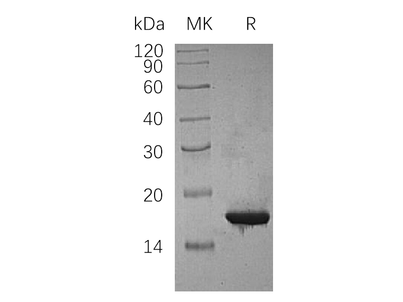 Recombinant Human CDKN2C (N-6His)