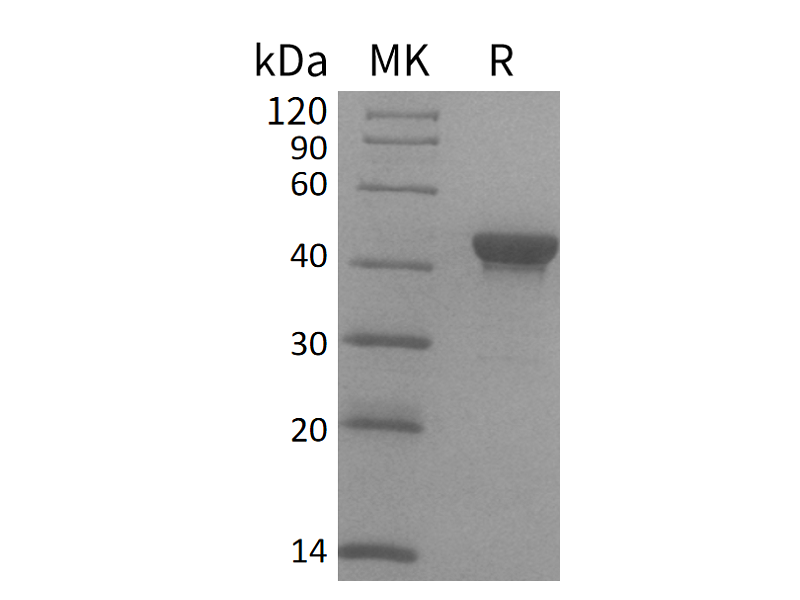 Recombinant Human CTH