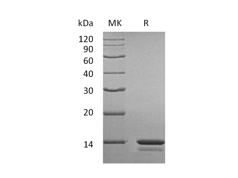 Recombinant Human CSTA (N-6His)