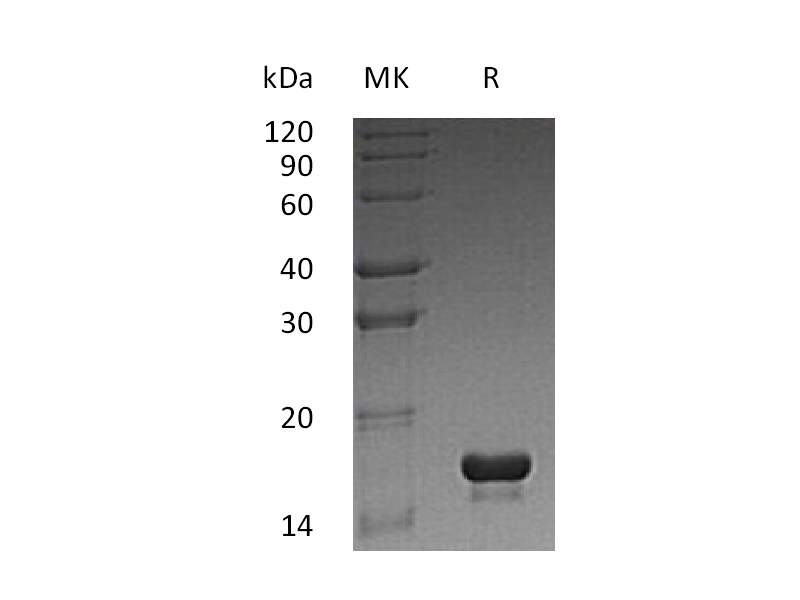 Recombinant Human CST3 (N-6His)
