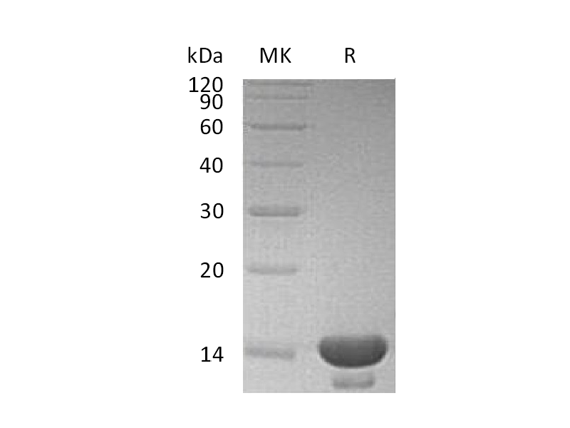 Recombinant Human CST3