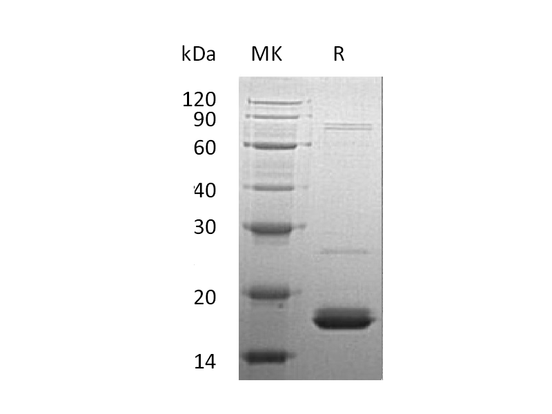 Recombinant Human CYB5A (N-6His)