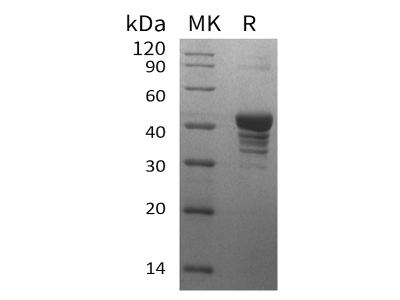 Recombinant Human UQCRH (N-GST)