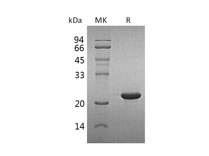 Recombinant Human CYGB (C-6His)