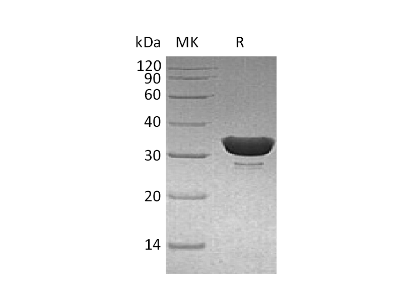 Recombinant Human DCUN1D1 (N-6His)