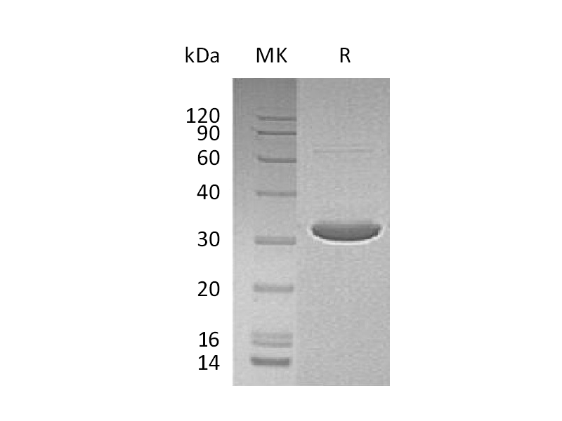 Recombinant Human DCK (N-6His-T7)
