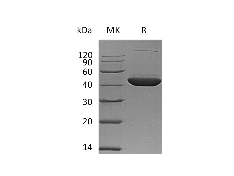 Recombinant Human DHS (C-6His)