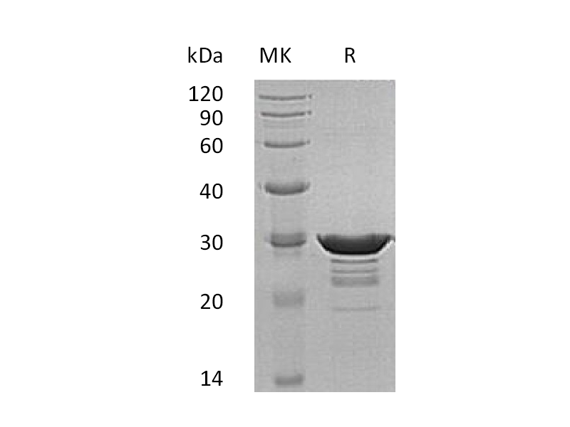 Recombinant Human Desmin (N-6His)